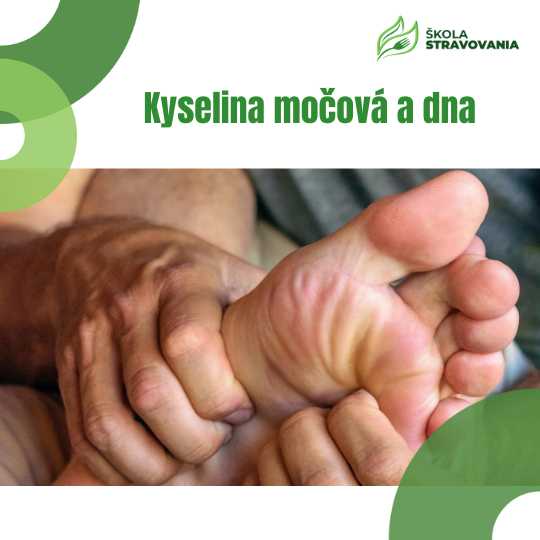 Kyselina močová a dna